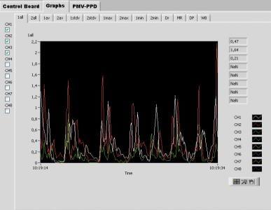 Swema Multipoint software